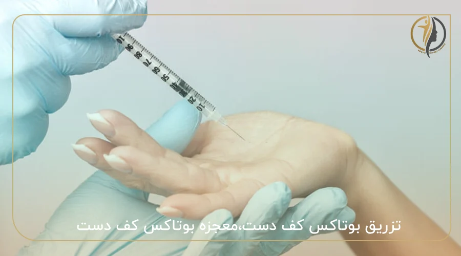 تزریق بوتاکس کف دست،معجزه بوتاکس کف دست