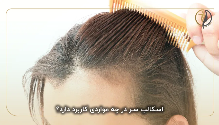 اسکالپ سر در چه مواردی کاربرد دارد؟