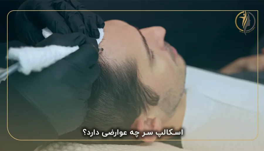 اسکالپ سر چه عوارضی دارد؟