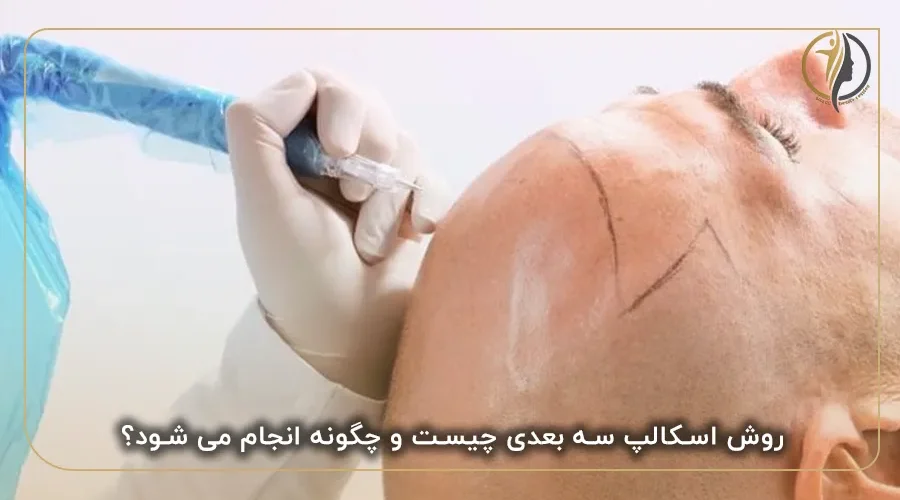 روش اسکالپ سه بعدی چیست و چگونه انجام می شود؟