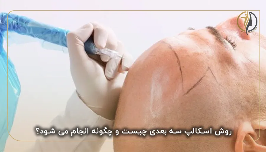 روش اسکالپ سه بعدی چیست و چگونه انجام می شود؟