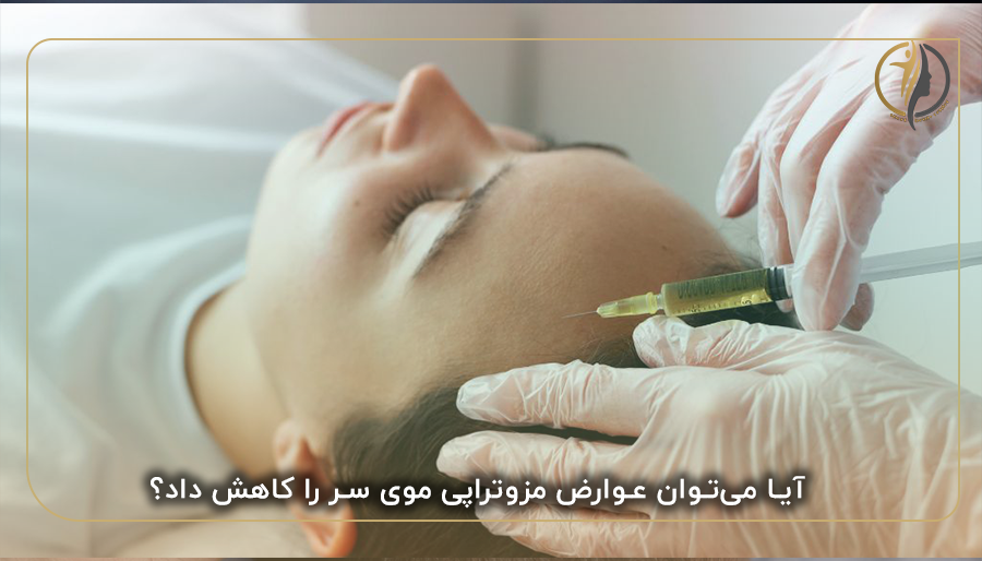 آیا می‌توان عوارض مزوتراپی موی سر را کاهش داد؟