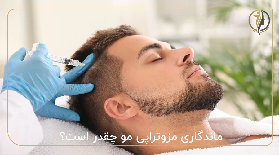 ماندگاری مزوتراپی مو چقدر است؟