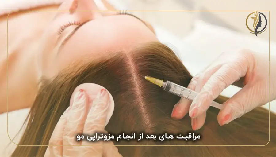 مراقبت های بعد از انجام مزوتراپی مو