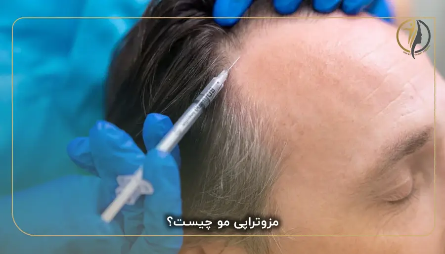 مزوتراپی مو چیست؟