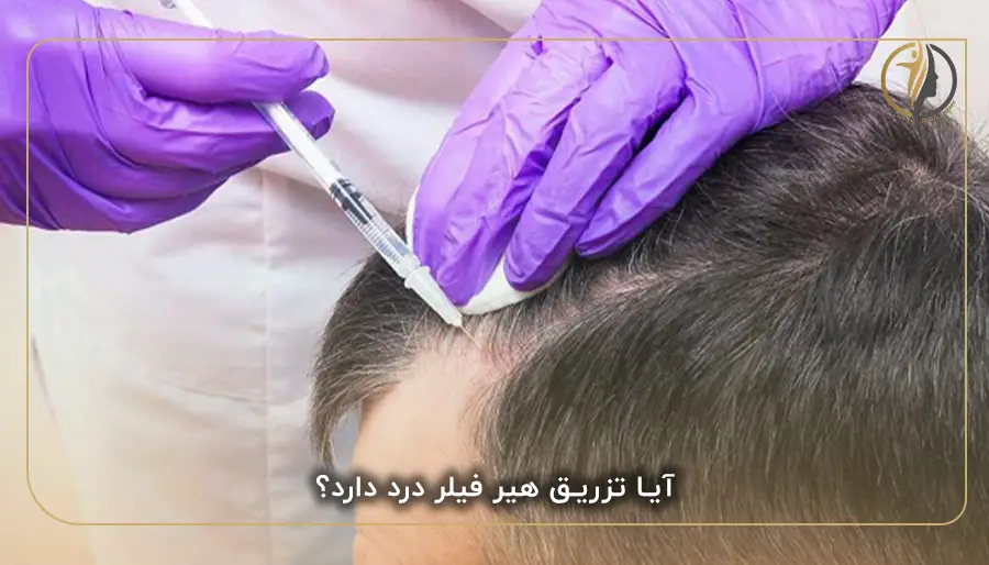 آیا تزریق هیر فیلر درد دارد؟