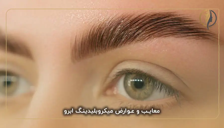 معایب و عوارض میکروبلیدینگ ابرو