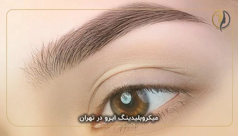 میکروبلیدینگ ابرو در تهران