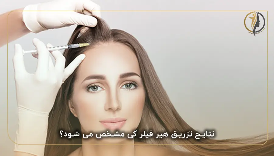 نتایج تزریق هیر فیلر کی مشخص می شود؟