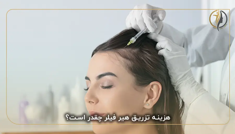 هزینه تزریق هیر فیلر چقدر است؟