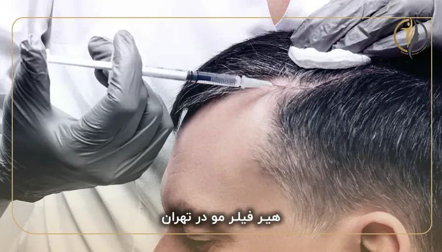 هیر فیلر مو در تهران
