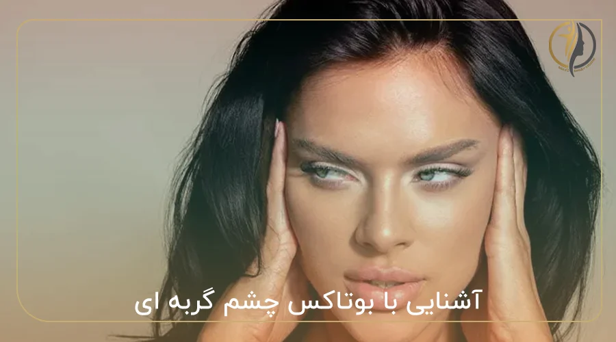 آشنایی با بوتاکس چشم گربه ای