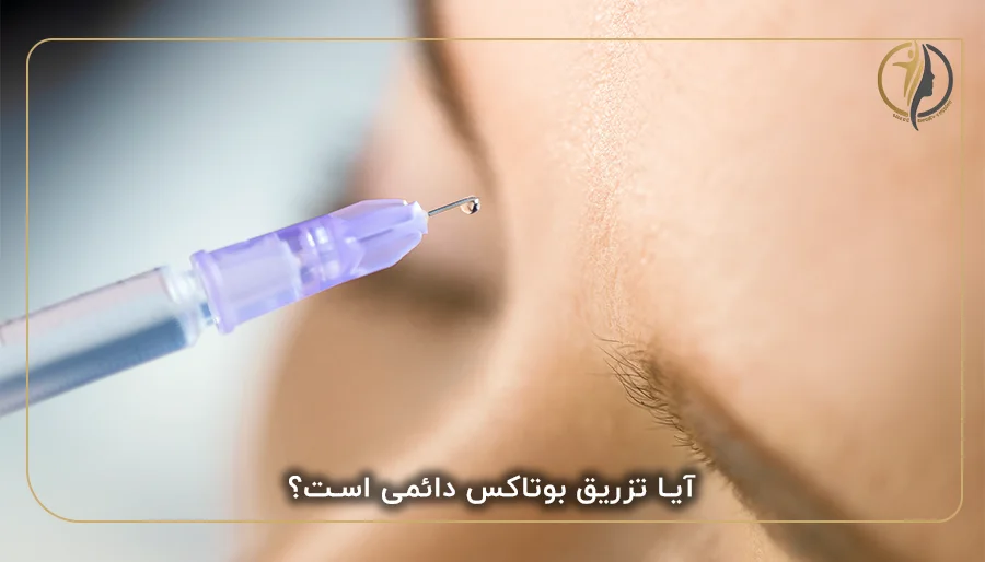 آیا تزریق بوتاکس دائمی است؟