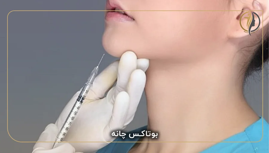 بوتاکس چانه