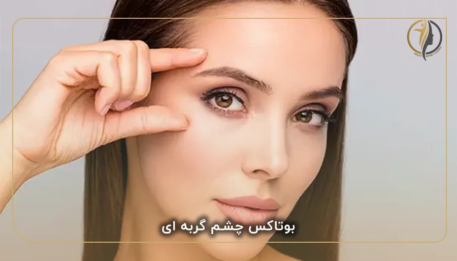 بوتاکس چشم گربه ای