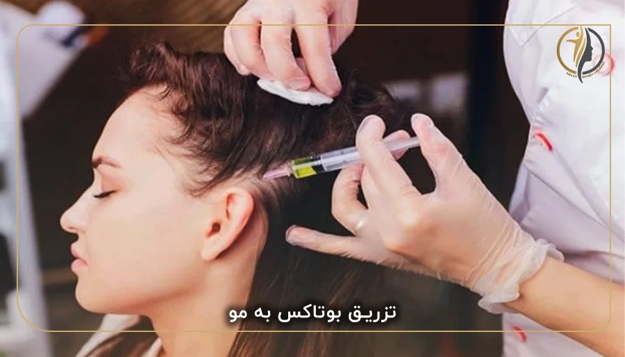 تزریق بوتاکس به مو
