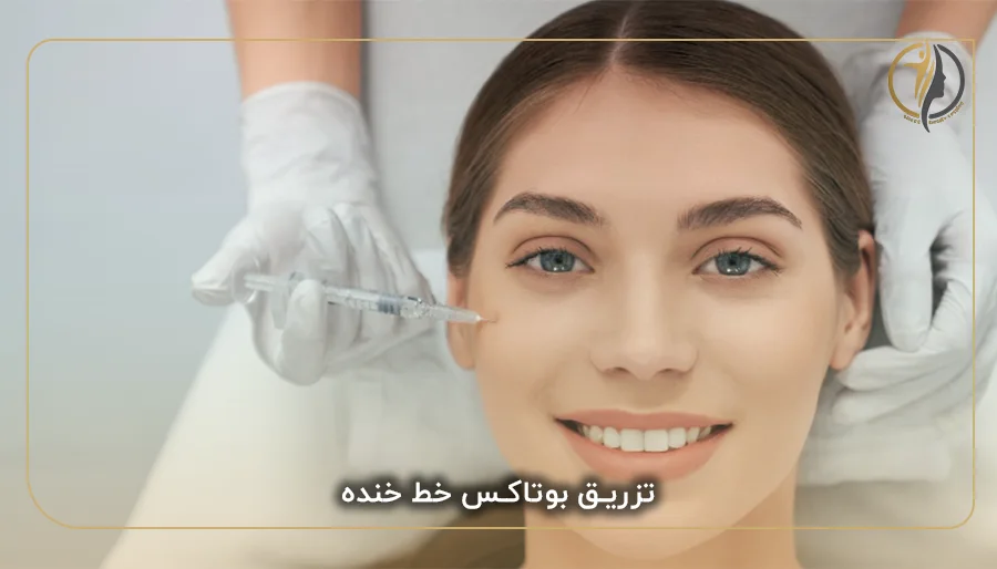 تزریق بوتاکس خط خنده