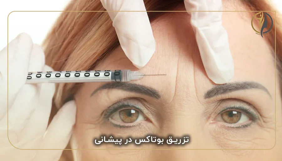  تزریق بوتاکس در پیشانی