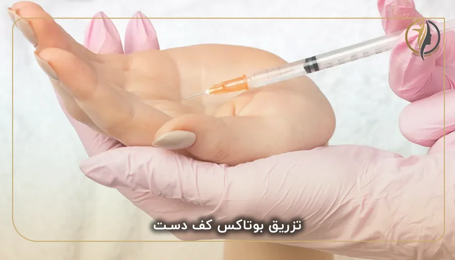 تزریق بوتاکس کف دست