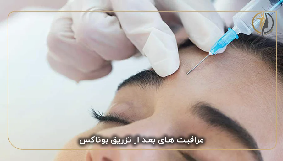 مراقبت های بعد از تزریق بوتاکس