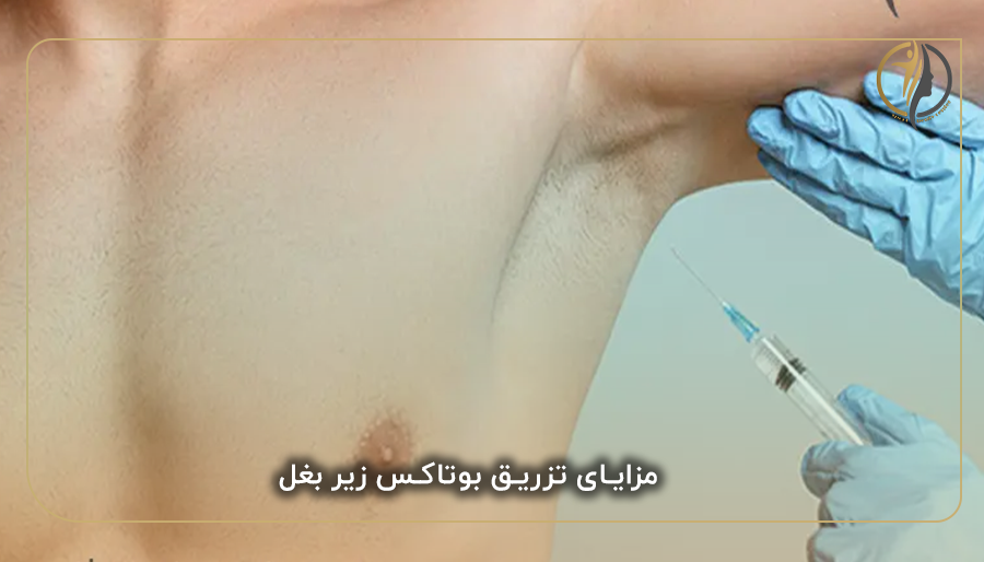  مزایای تزریق بوتاکس زیر بغل