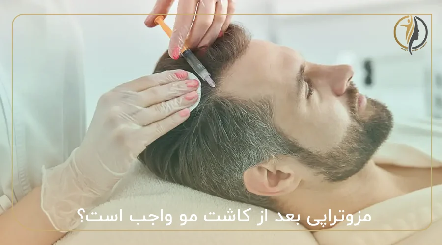 مزوتراپی بعد از کاشت مو واجب است؟