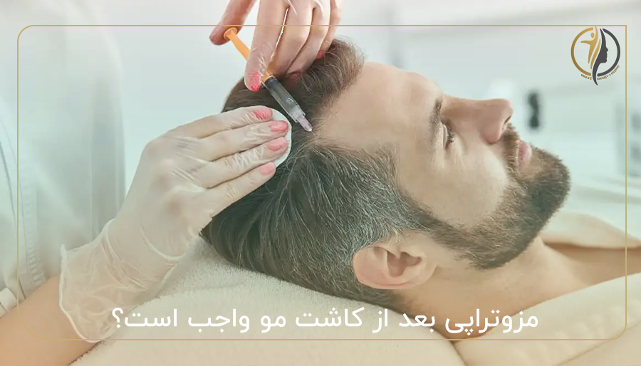 مزوتراپی بعد از کاشت مو واجب است؟