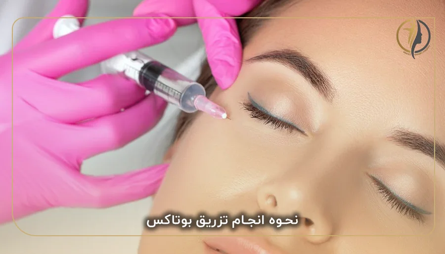 نحوه انجام تزریق بوتاکس