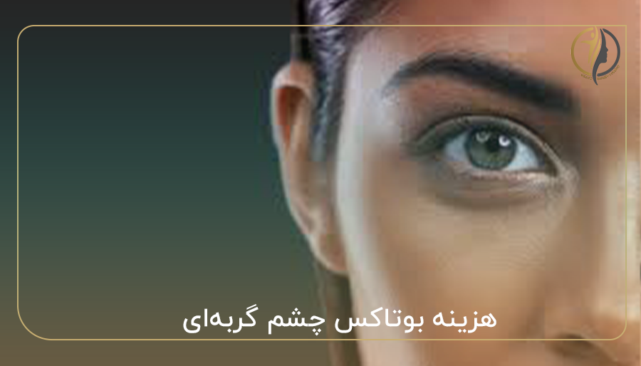 هزینه بوتاکس چشم گربه‌ای