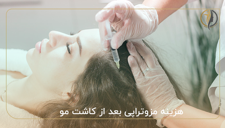 هزینه مزوتراپی بعد از کاشت مو