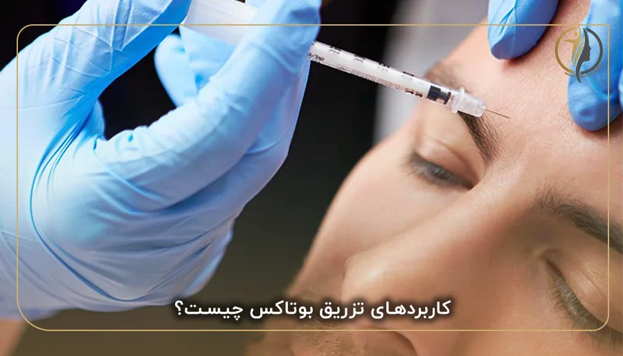 کاربردهای تزریق بوتاکس چیست؟