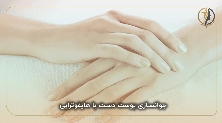 جوانسازی پوست دست با هایفوتراپی