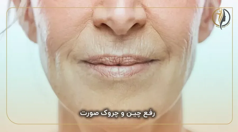 رفع چین و چروک صورت