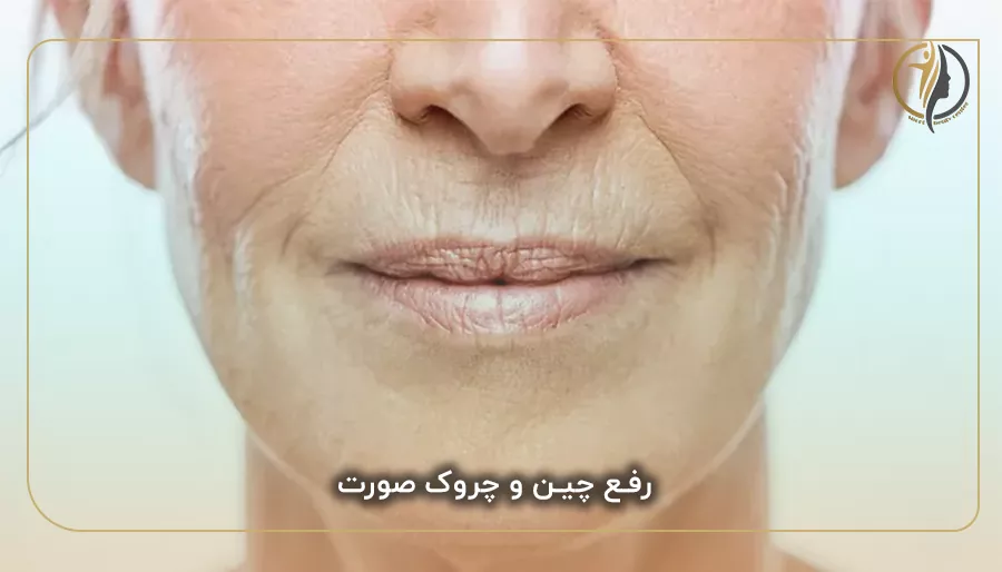 رفع چین و چروک صورت