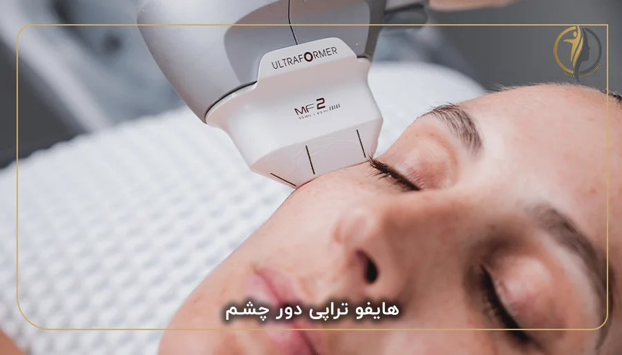 هایفو تراپی دور چشم
