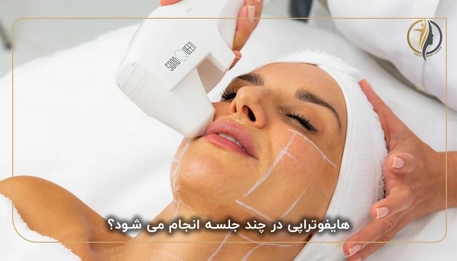 هایفوتراپی در چند جلسه انجام می شود؟