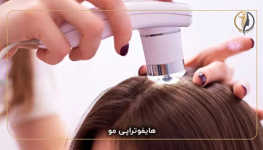 هایفوتراپی مو